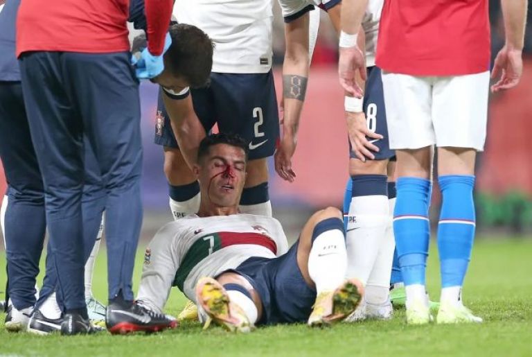 Cristiano Ronaldo recibió un duro golpe y asustó a todos en el partido de Portugal ante República Checa