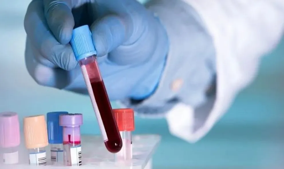 Esperanzador: un análisis de sangre podría detectar hasta 50 tipos de cáncer antes de los síntomas