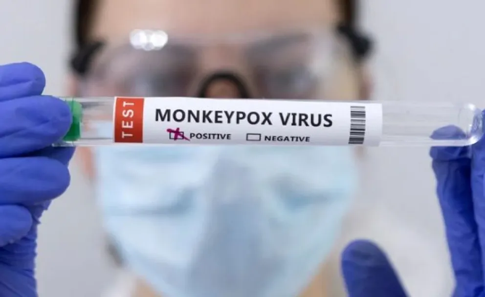 Viruela del mono: cuáles son los cinco fármacos que se han propuesto para controlarla