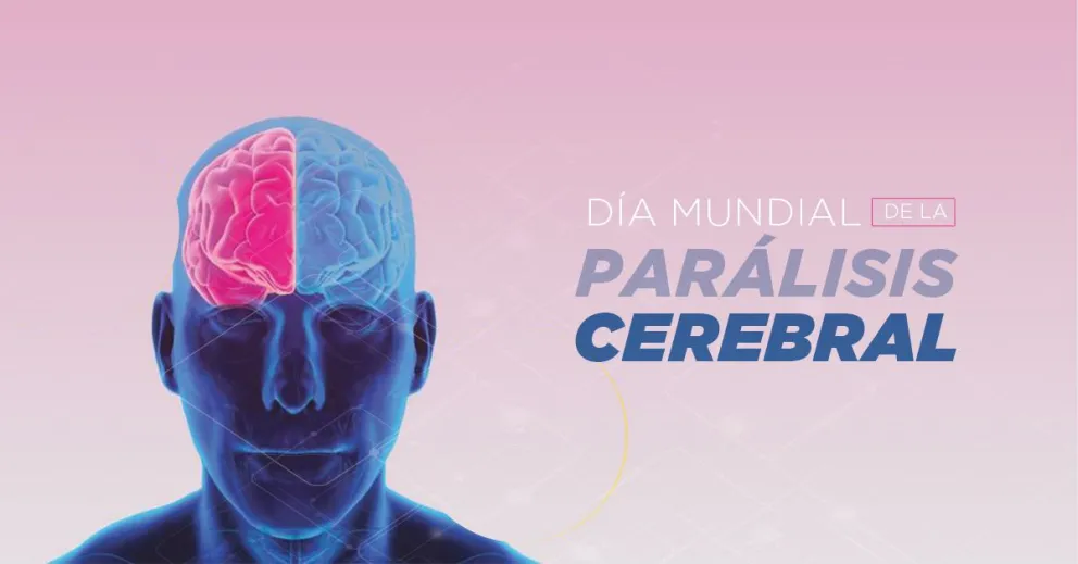 Día Mundial de la Parálisis Cerebral: conoce sobre la problemática que afecta a 1 de 500 personas