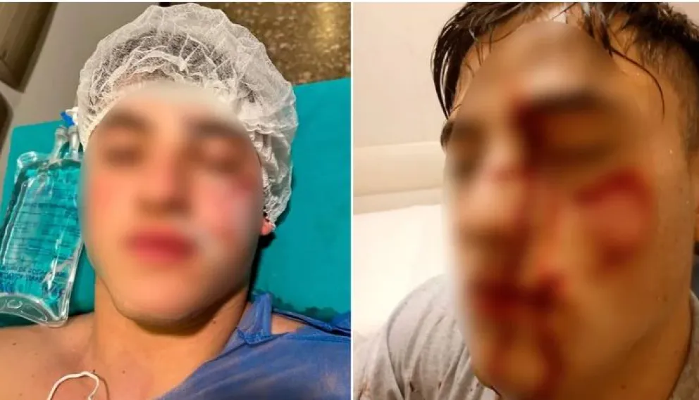 Horror: un joven vio a otro hablar con su exnovia y le arrancó parte de la cara con una botella 