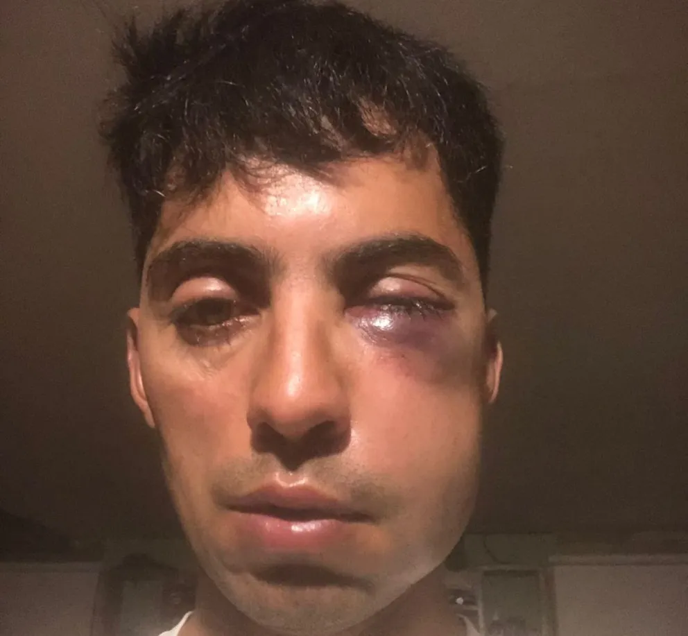 El sonidista agradeció los mensajes de apoyo