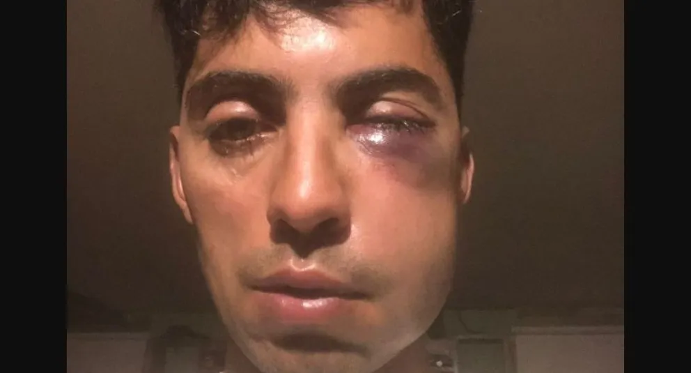 El mánager de Sele Vera envuelto en un episodio que concluyó con la fractura de pómulo de un sonidista