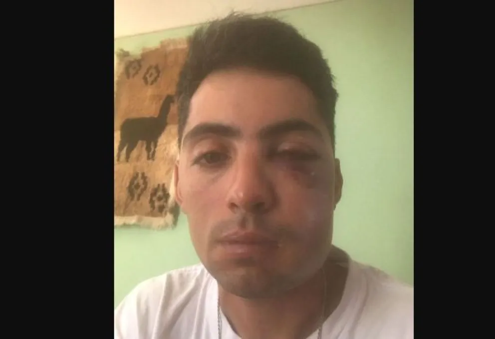 Múltiples voces de apoyo al sonidista agredido por el manager de Sele Vera y Los Pampas