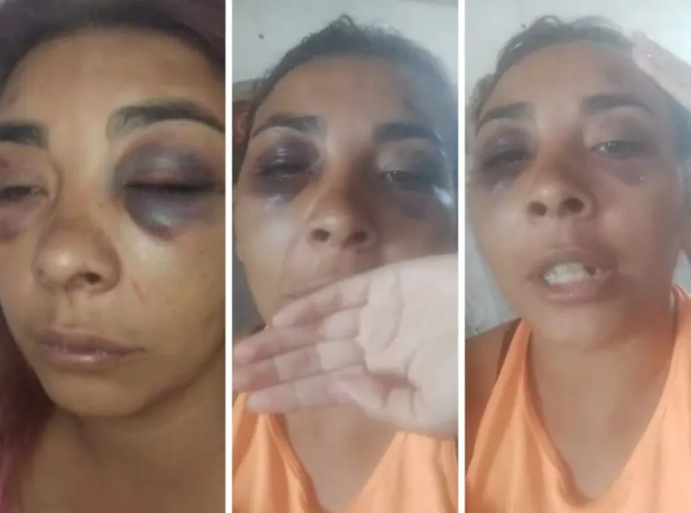 Feroz golpiza a una mujer delante de sus hijos: denuncian que fue la pareja de un concejal de San Antonio Oeste