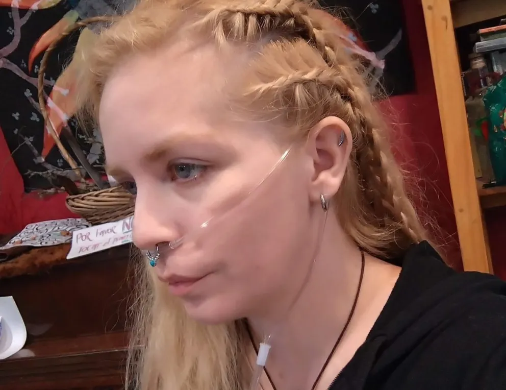 Video: el desesperado pedido de ayuda de Fanny para afrontar una operación compleja 