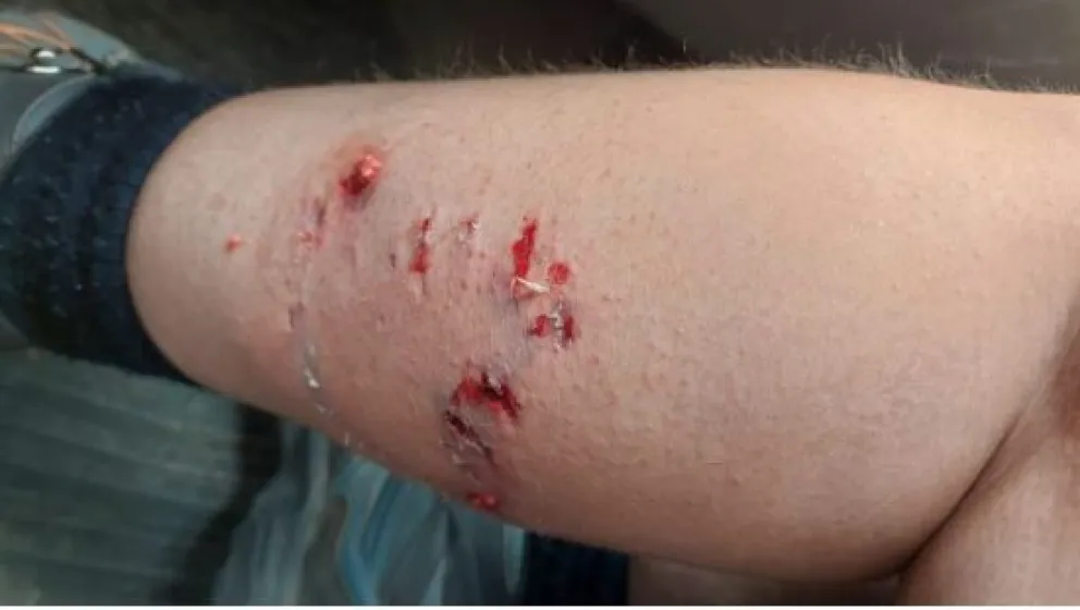 Dos perros callejeros atacaron a una turista