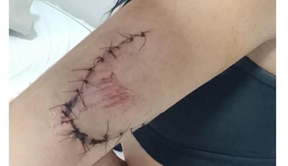 Una joven fue violentamente agredida durante los festejos de Argentina  