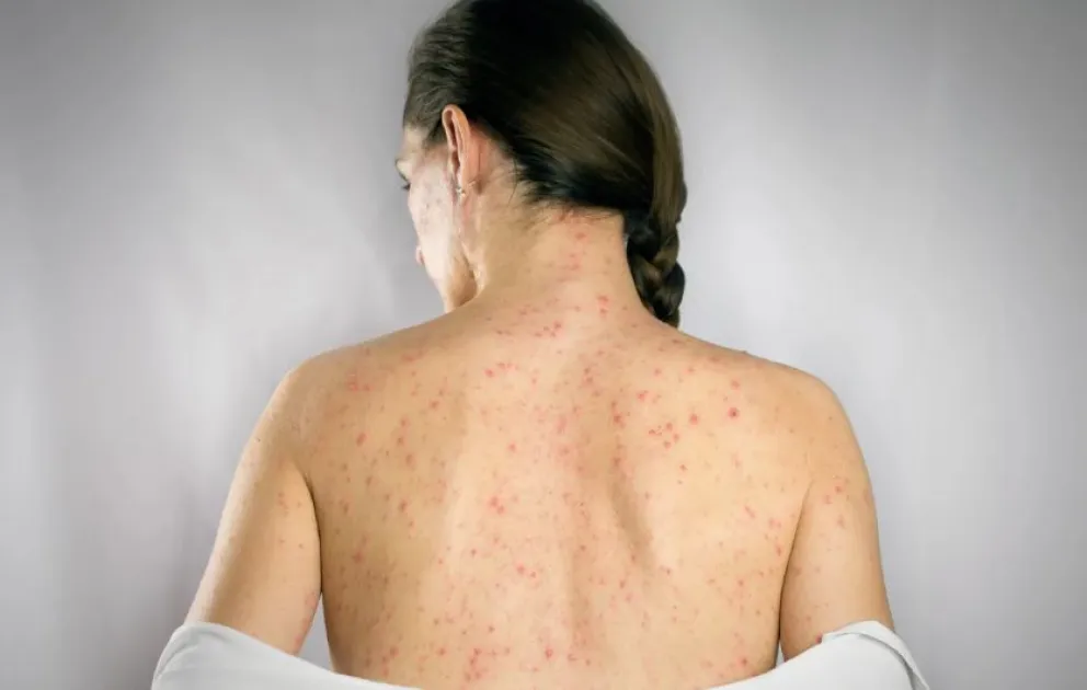 Estas son las recomendaciones del Ministerio de Salud para quienes vuelvan de Qatar