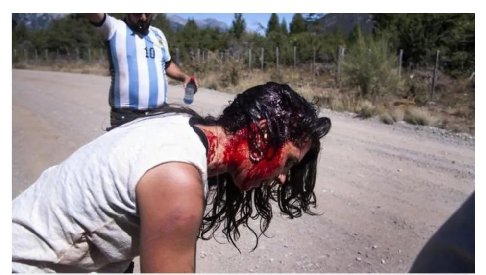 Mientras la Justicia rechaza el amparo, se suman los heridos en el intento de ingreso al lago Escondido
