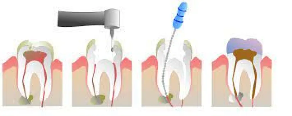 Desarrollo de la odontología y sus especialidades principales