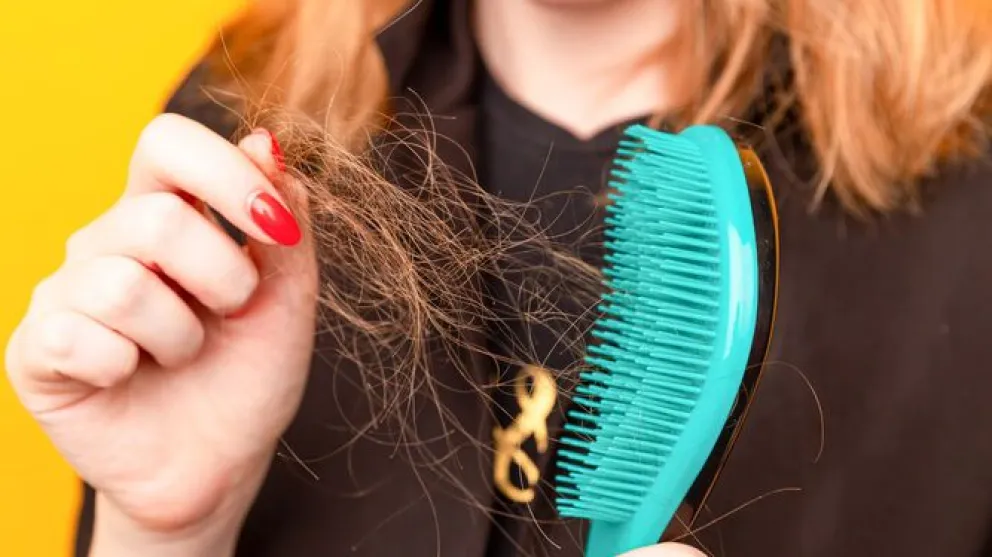 Alopecia: cuáles son las causas de la caída del cabello y cómo evitarla