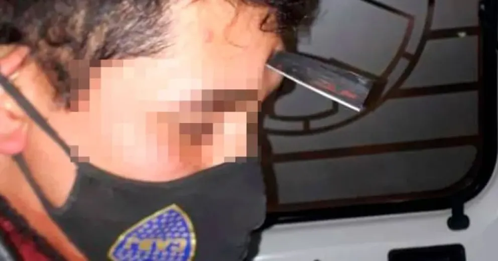 Agredió a un vecino con un elemento punzante y hurtó una máquina de cortar césped