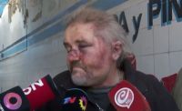 Un hombre desfiguró a su mecánico porque demoró en entregarle el auto